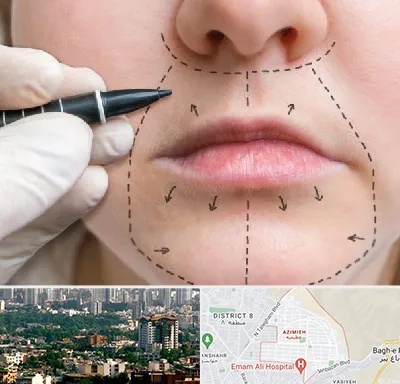 عمل سانترال لب در عظیمیه کرج 
