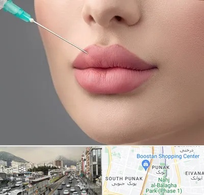 کلینیک ژل لب روسی در پونک 