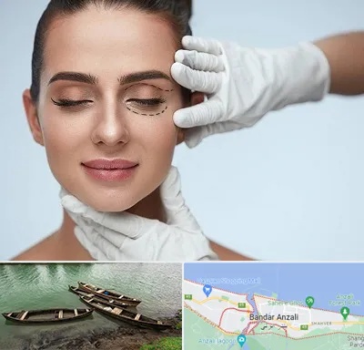 عمل پف چشم در بندر انزلی