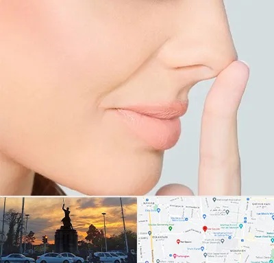 عمل تیپ پلاستی بینی در میدان حر 