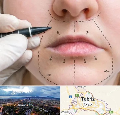 عمل سانترال لب در تبریز