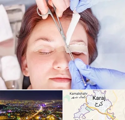 جراحی پلک افتاده در کرج