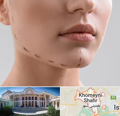 عمل زاویه فک در خمینی شهر