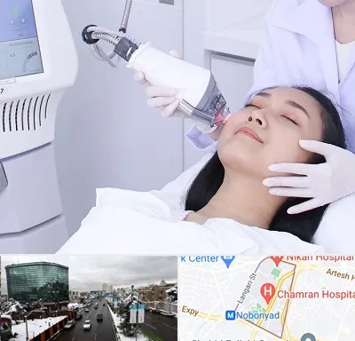 وایتنینگ در اقدسیه 
