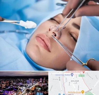 عمل ترمیمی بینی در گلسار رشت 