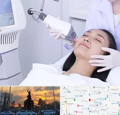 وایتنینگ در میدان حر 