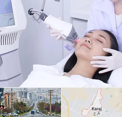 وایتنینگ در گوهردشت کرج 