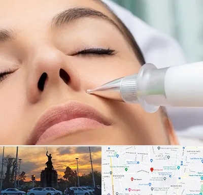 پلاسما جت بینی در میدان حر 