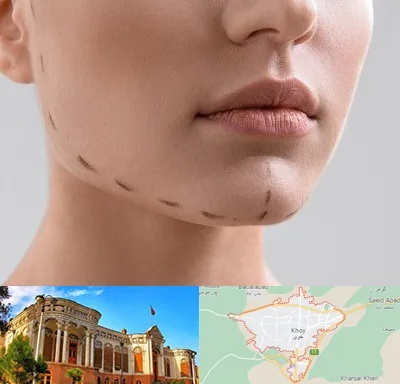 عمل زاویه فک در خوی