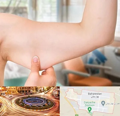 براکیوپلاستی در بهارستان
