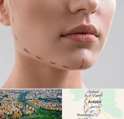 عمل زاویه فک در اردبیل