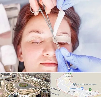جراحی پلک افتاده در پرند