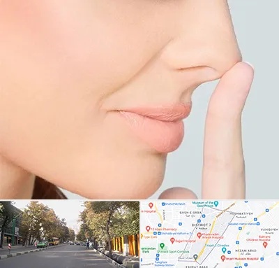 عمل تیپ پلاستی بینی در شریعتی 