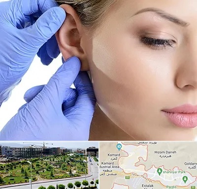 اتوپلاستی در پردیس