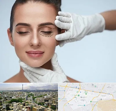 عمل پف چشم در منطقه 8 تهران 