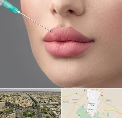 کلینیک ژل لب روسی در قزوین