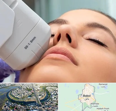 هایفوتراپی در بابل