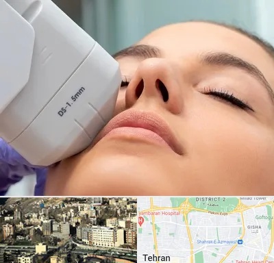 هایفوتراپی در مرزداران 