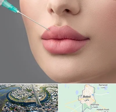 کلینیک ژل لب روسی در بابل