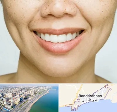 عمل چال گونه در بندرعباس