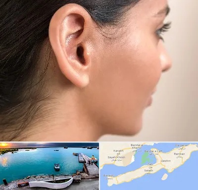 عمل گوش بل در قشم