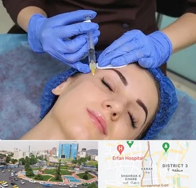 تزریق پروفایلو در ونک 