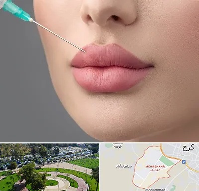 کلینیک ژل لب روسی در مهرشهر کرج 
