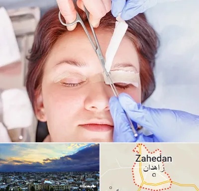 جراحی پلک افتاده در زاهدان