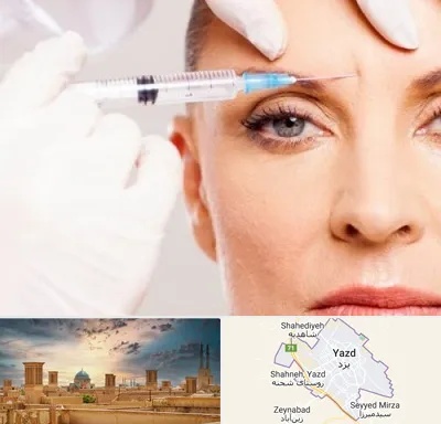 مزوژل در یزد