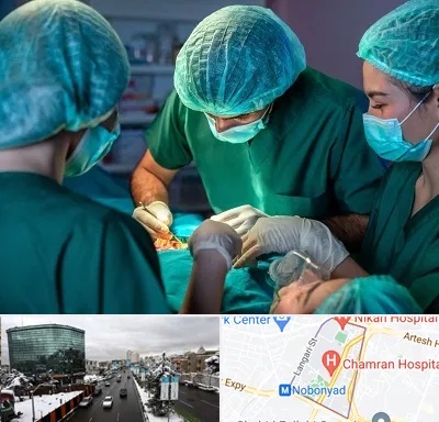 عمل کوچک کردن سینه در اقدسیه 