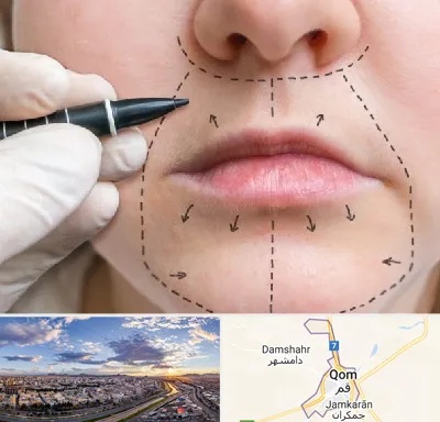 عمل سانترال لب در قم