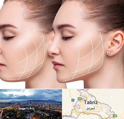 جراحی بوکال فت در تبریز