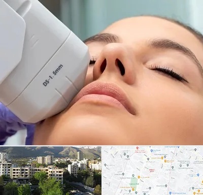 هایفوتراپی در دیباجی 