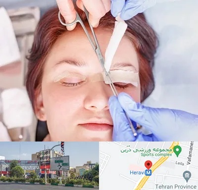 جراحی پلک افتاده در هروی 