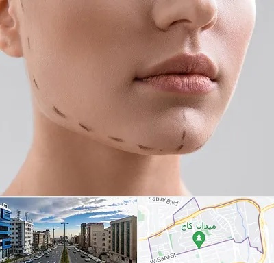 عمل زاویه فک در سعادت آباد 