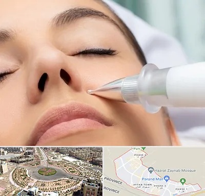 پلاسما جت بینی در پرند