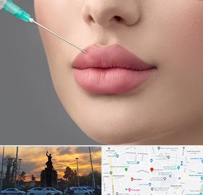 کلینیک ژل لب روسی در میدان حر 
