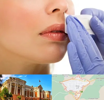 اپیلاسیون صورت در خوی