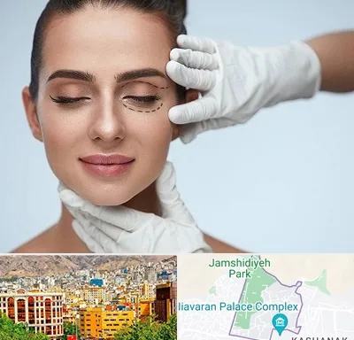 عمل پف چشم در نیاوران 