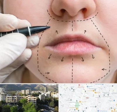 عمل سانترال لب در دیباجی 