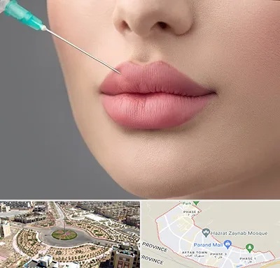 کلینیک ژل لب روسی در پرند