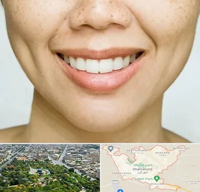 عمل چال گونه در شهرکرد