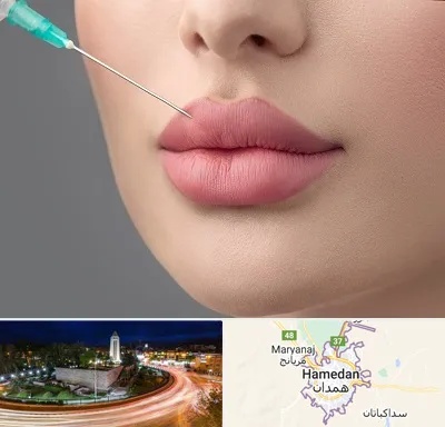 کلینیک ژل لب روسی در همدان