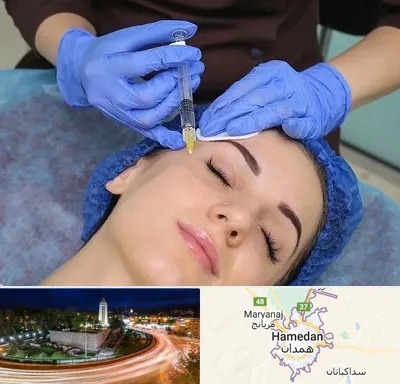 تزریق پروفایلو در همدان