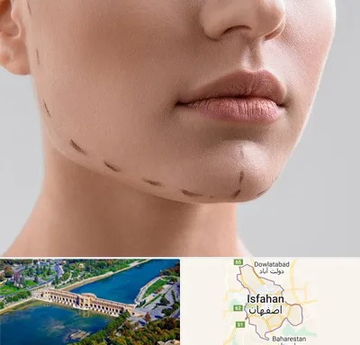 عمل زاویه فک در اصفهان
