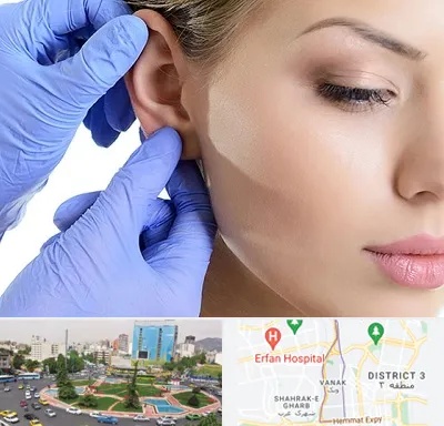 اتوپلاستی در ونک 