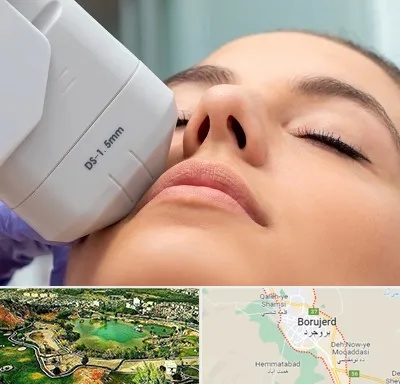 هایفوتراپی در بروجرد
