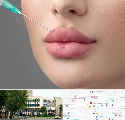 کلینیک ژل لب روسی در طالقانی 