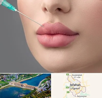 کلینیک ژل لب روسی در اصفهان