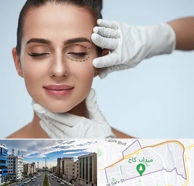 عمل پف چشم در سعادت آباد 
